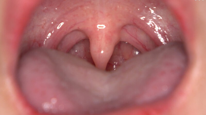 【無料フル】「【歯・口腔フェチ】新人女優相楽さゆなちゃんの口内観察＆巨大女フェチ」わかしラボWAKA-078 相楽さゆな 9｜h_1416ad02007