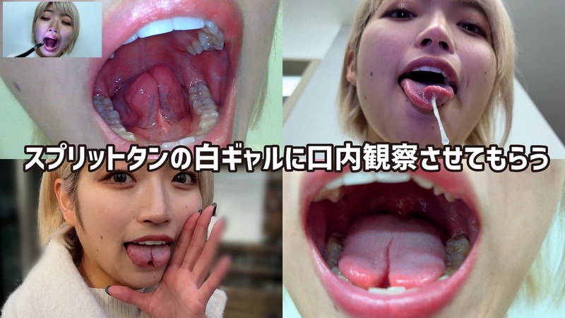 【無料フル】街角で声をかけて口内観察させてもらう 美容部員 はるのちゃん｜h_1651nko0500001